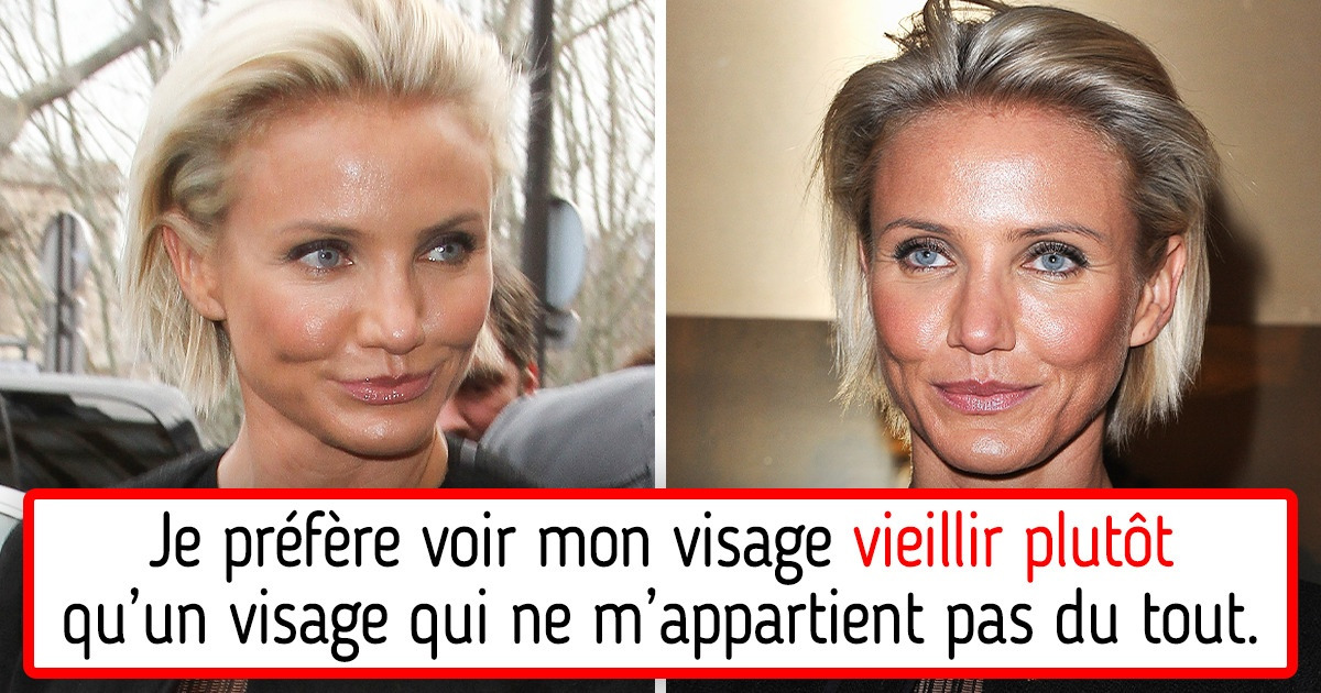 8 Célébrités qui ont essayé la chirurgie esthétique une fois et ont dit “plus jamais”
