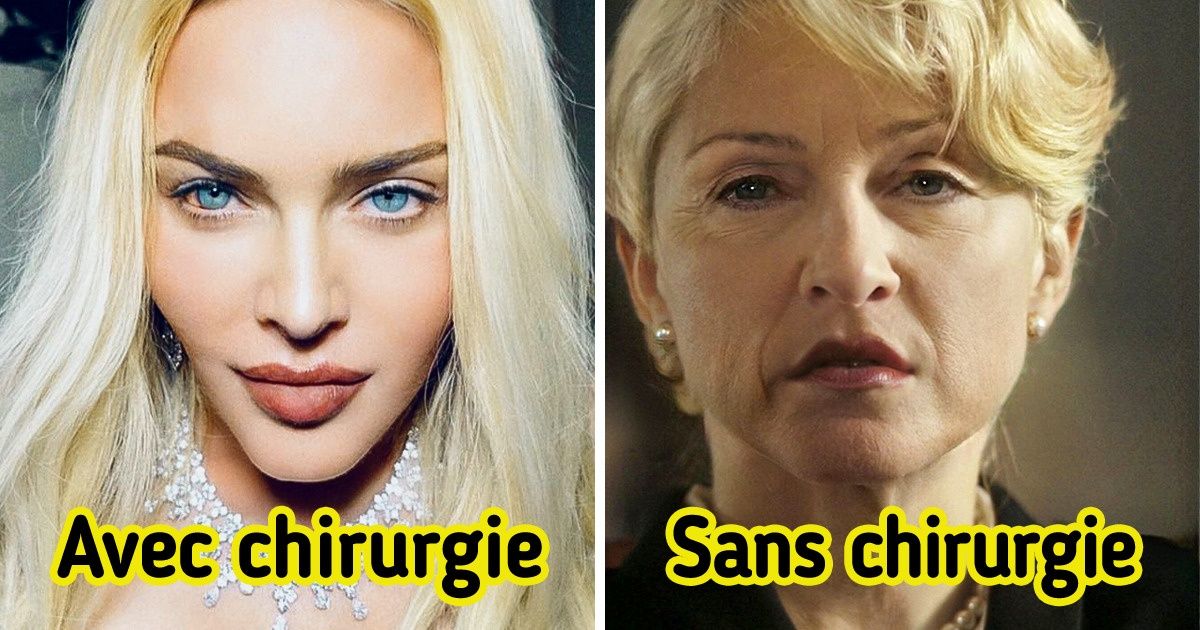 Voici à quoi ressembleraient ces 9 célébrités si elles avaient choisi de vieillir naturellement