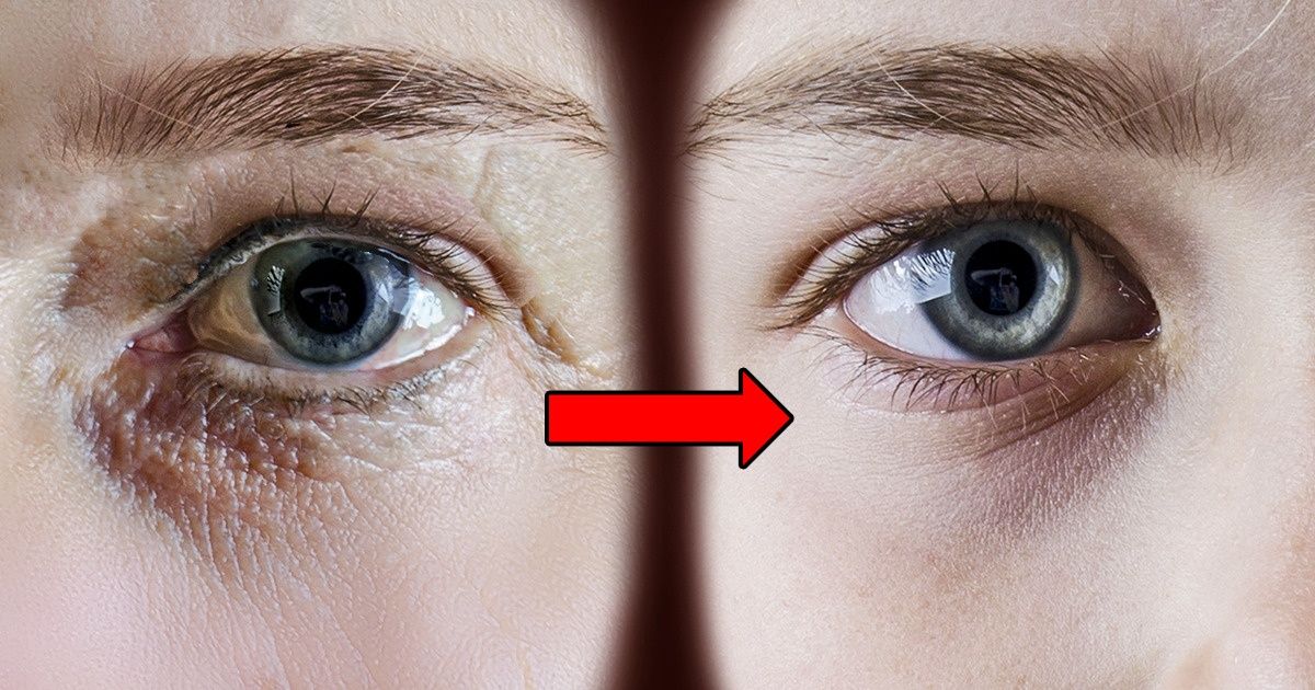 7 Exercices antirides qui peuvent éliminer les années marquées sur ton visage 7 Exercices antirides qui peuvent éliminer les années marquées sur ton visage