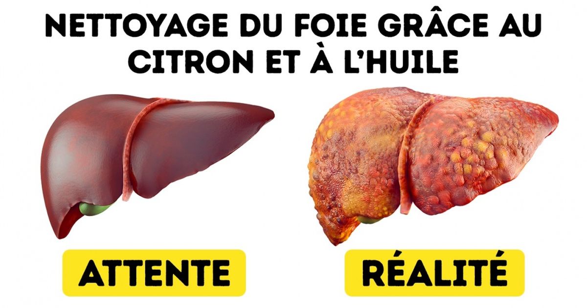 Ces techniques de médecine traditionnelle sont dangereuses pour ta santé