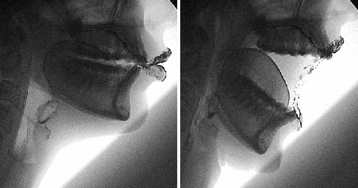 8 Choses incroyables qui prouvent que notre corps est le système le mieux pensé du monde 8 Choses incroyables qui prouvent que notre corps est le système le mieux pensé du monde