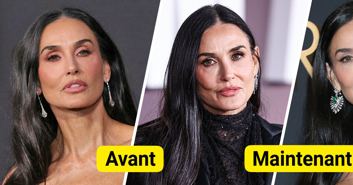 "Produits de comblement retirés", Demi Moore a été félicitée pour son apparence naturelle lors d'une récente sortie