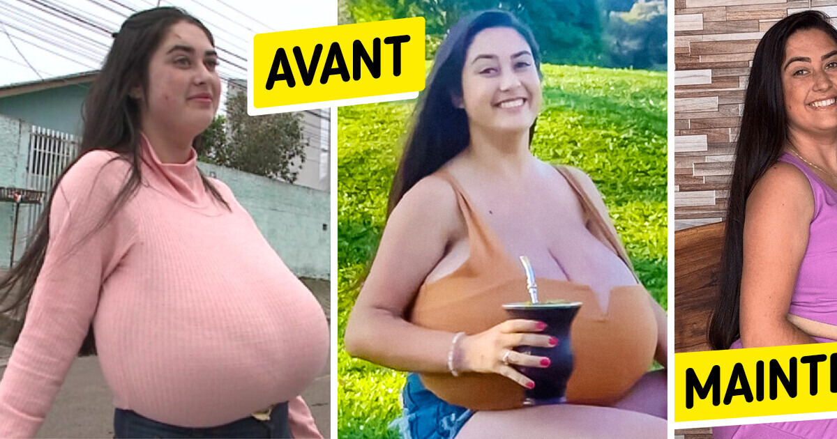Une jeune femme procède à une chirurgie mammaire pour retirer 10 kg de poitrine
