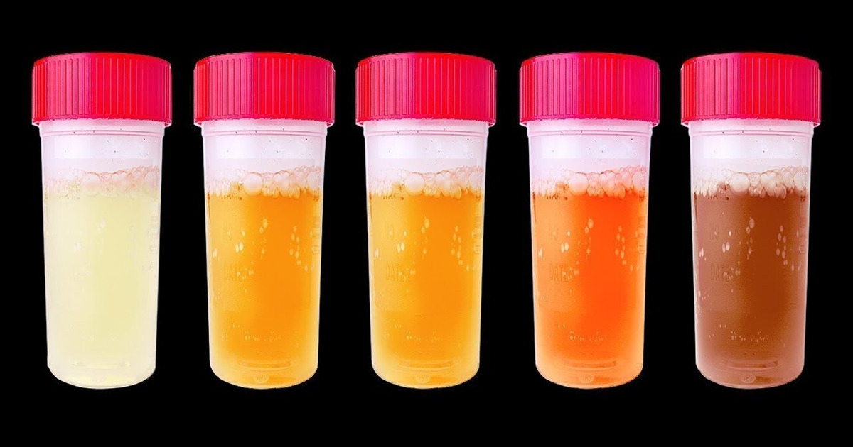 7 Choses Que Ton Urine Peut Révéler Sur ta Santé 7 Choses Que Ton Urine Peut Révéler Sur ta Santé