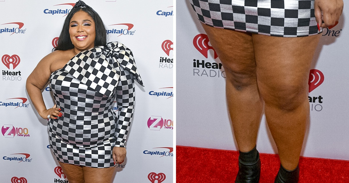 10+ Célébrités qui ont brisé tous les stéréotypes sur le physique parfait