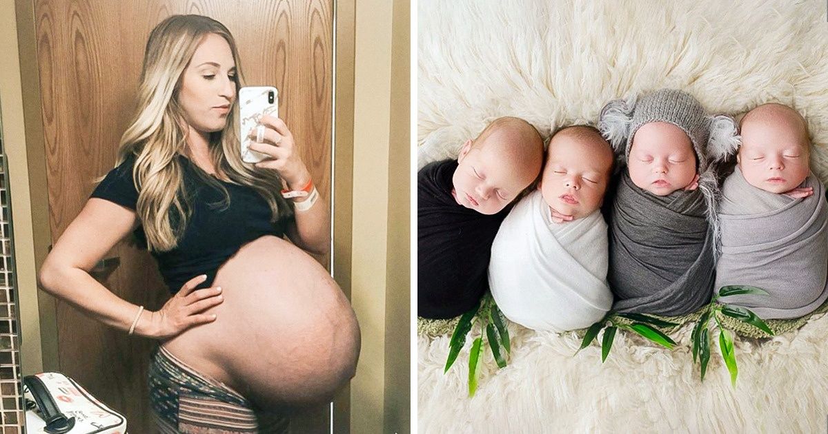Après 5 tentatives infructueuses, cette femme est tombée enceinte de quadruplés et nous a raconté son histoire inspirante Après 5 tentatives infructueuses, cette femme est tombée enceinte de quadruplés et nous a raconté son histoire inspirante