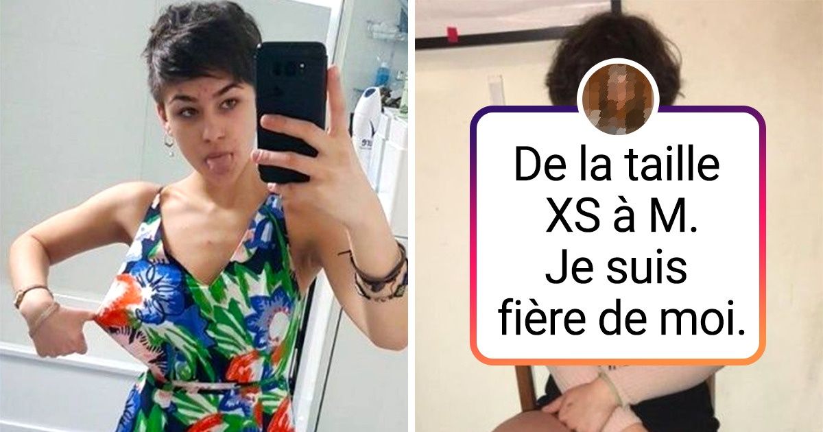 15 Personnes qui ont finalement réussi à voir leur beauté, qu’elles avaient du mal à reconnaître avant