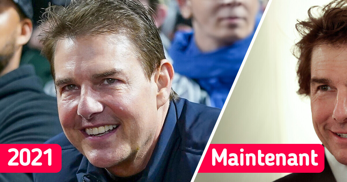 Tom Cruise est méconnaissable sur de nouvelles photos avec le prince William, alors que certains disent qu’il a fait “trop de chirurgie” Tom Cruise est méconnaissable sur de nouvelles photos avec le prince William, alors que certains disent qu’il a fait “trop de chirurgie”