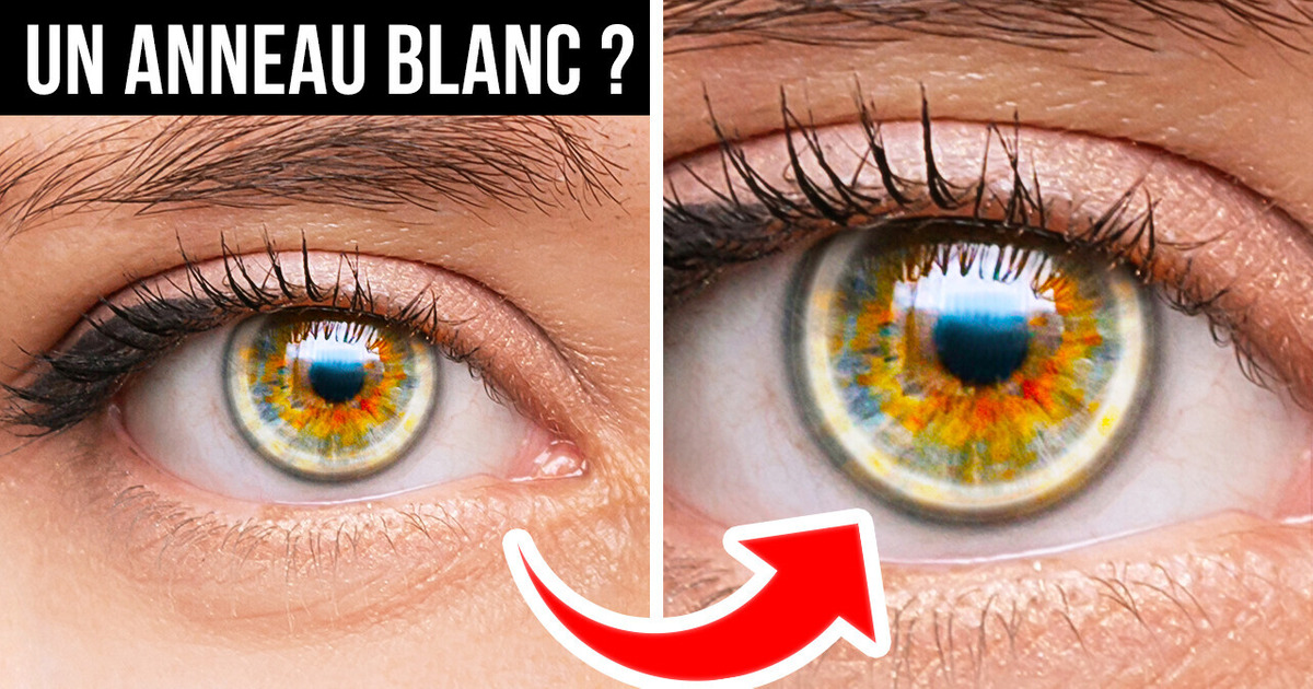 Tu Peux te Considérer Unique Si Tu as l’Une de Ces Caractéristiques Physiques