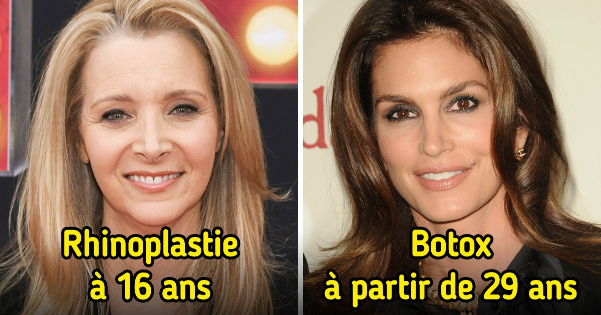 11 Stars qui ont décidé de recourir à la chirurgie plastique sans inventer des histoires de loterie génétique