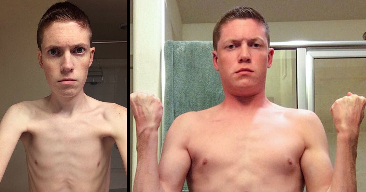 25 Hommes ont partagé les photos “avant” et “après” certains changements drastiques dans leur vie.