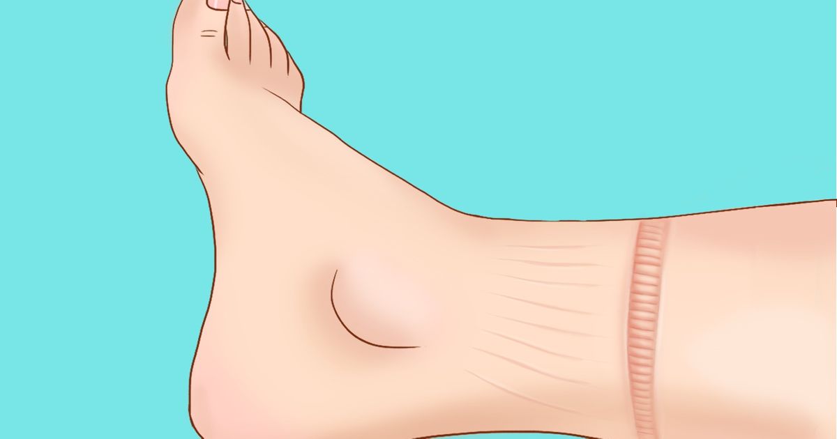 8 Signes qui indiquent que ton cœur ne fonctionne pas correctement 8 Signes qui indiquent que ton cœur ne fonctionne pas correctement