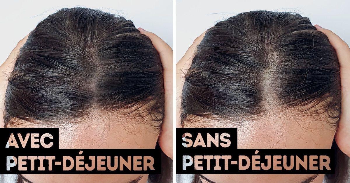 10 Mauvaises habitudes quotidiennes qui te font perdre tes cheveux