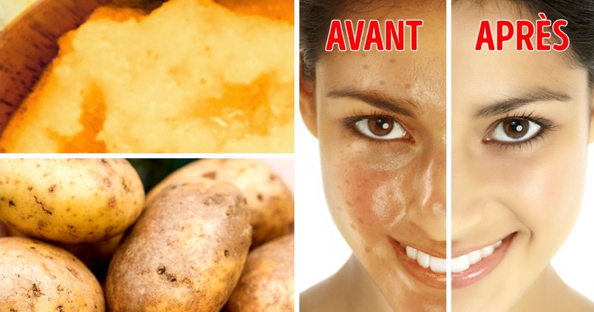 Ces 8 aliments cachent de surprenantes vertus cosmétiques