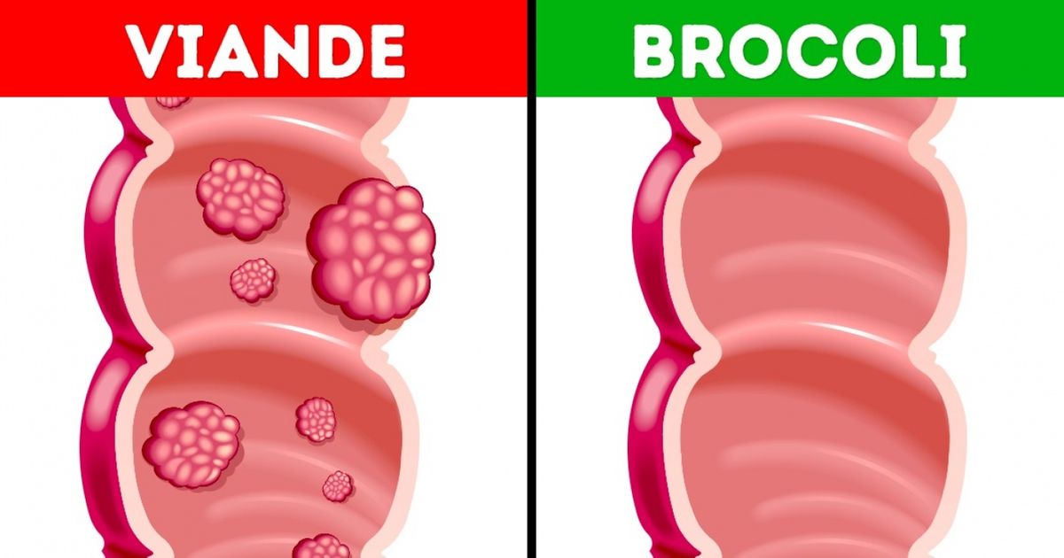 5 Aliments dont tu as besoin si tu as un travail sédentaire