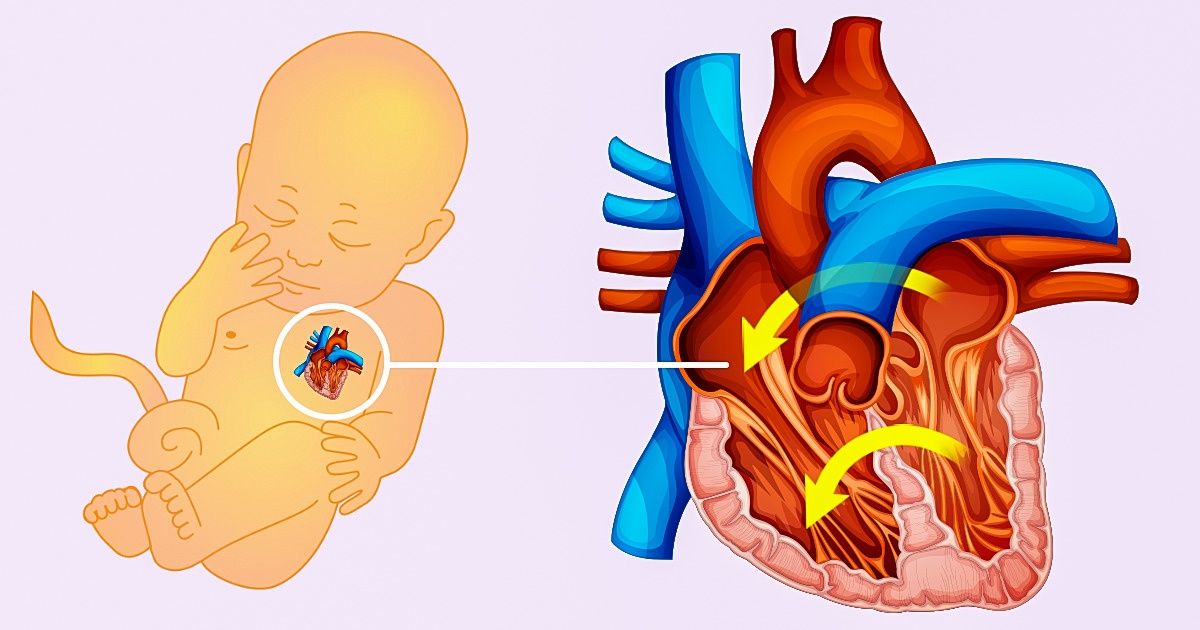 Voici Les Symptomes D Une Malformation Cardiaque Qui Devrait Etre Detectee A Temps Chez Le Bebe Sympa