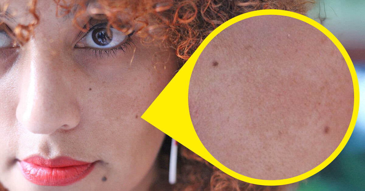 9 Choses que ton visage peut révéler sur ta santé 9 Choses que ton visage peut révéler sur ta santé