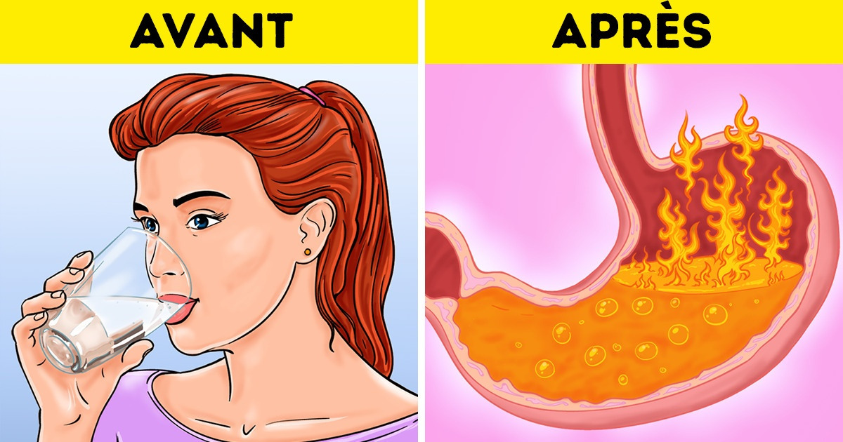 6 Habitudes qui pourraient aggraver ton reflux acide, et comment y remédier