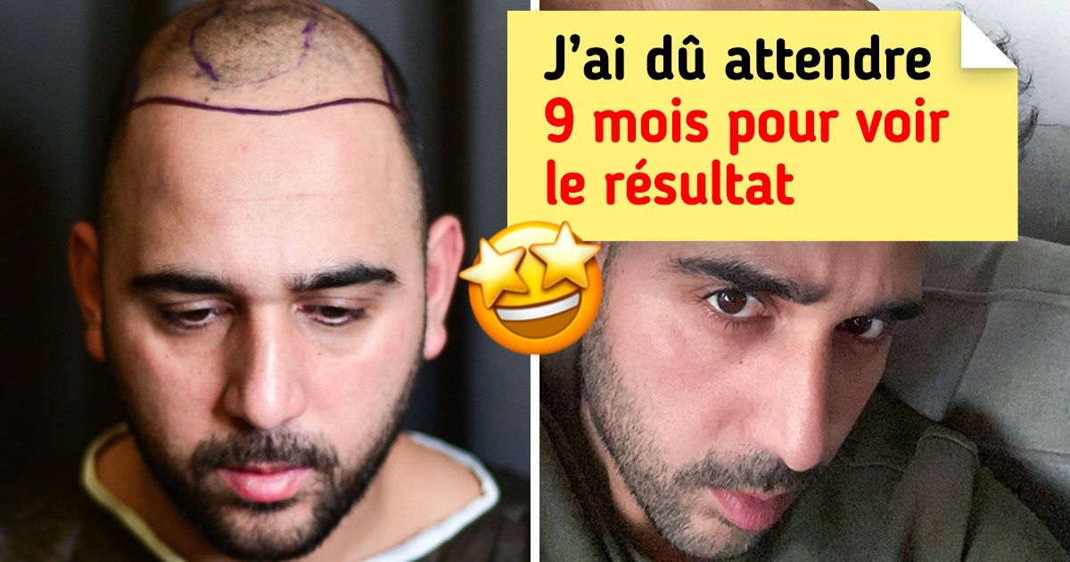 20 Personnes qui ont décidé de faire de grands changements dans leur vie, en commençant par leur apparence