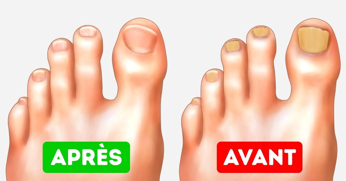 10 Conseils faciles pour que tes pieds soient parfaits