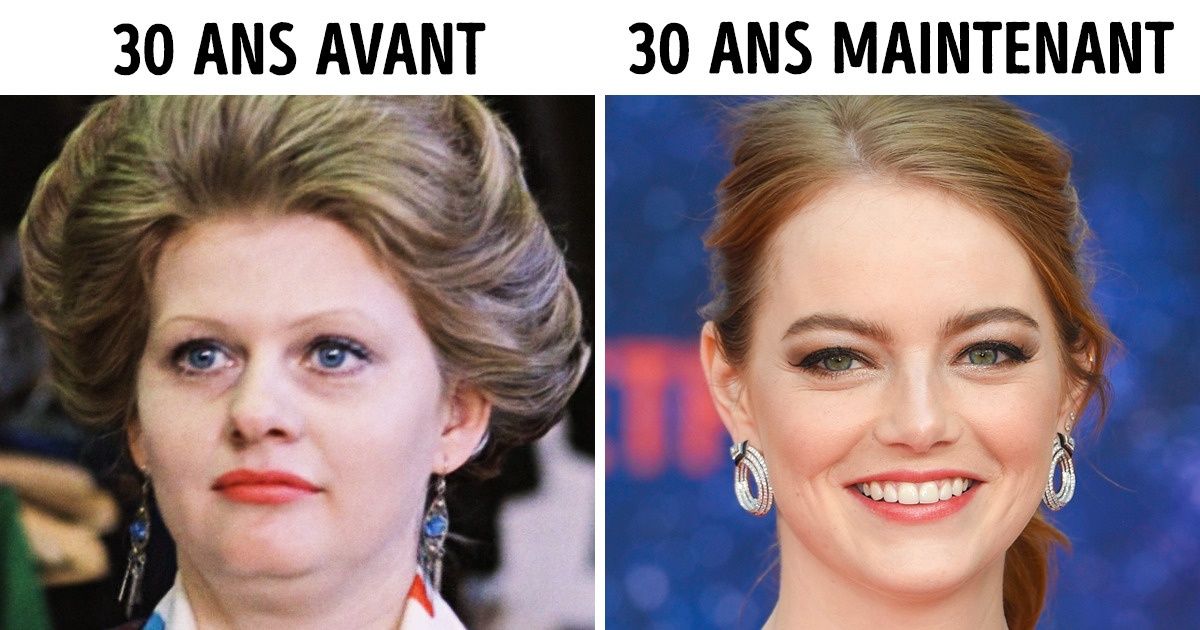 Pourquoi les femmes de 30 ans aujourd’hui apparaissent “plus jeunes” que celles qui avaient le même âge il y a quelques années Pourquoi les femmes de 30 ans aujourd’hui apparaissent “plus jeunes” que celles qui avaient le même âge il y a quelques années