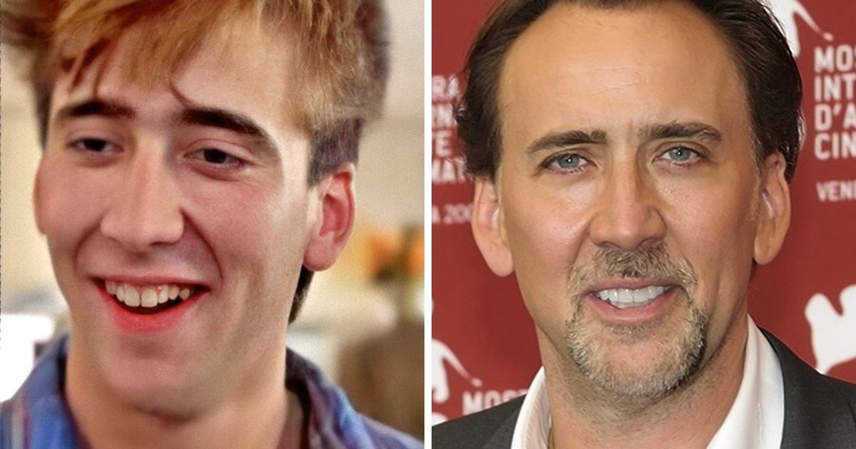 13 Célébrités qui ont complètement changé leur denture quand elles sont devenues des stars