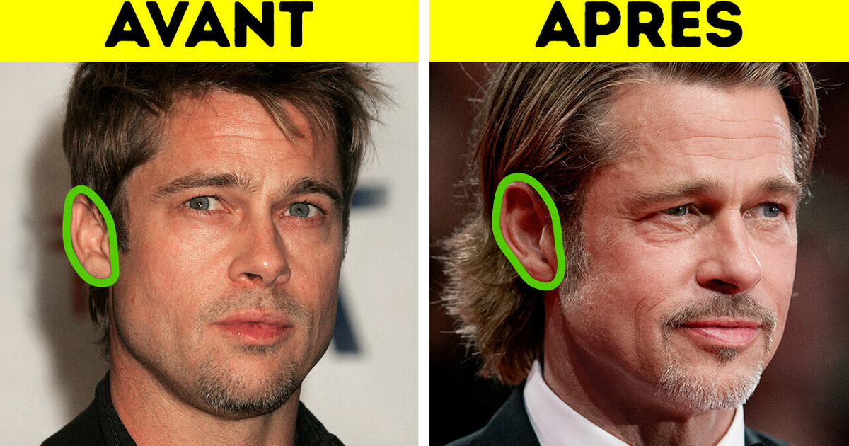 Est-Il Vrai Que Nos Oreilles Ne Cessent Jamais De Grandir ? Est-Il Vrai Que Nos Oreilles Ne Cessent Jamais De Grandir ?