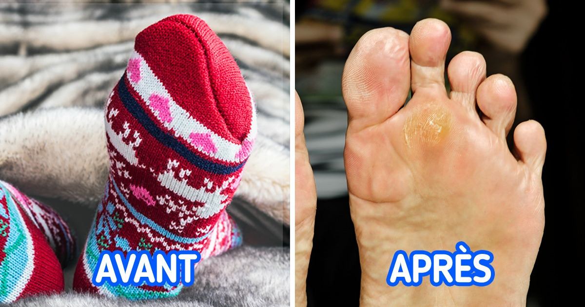 Voici ce qui peut arriver si tu dors avec des chaussettes Voici ce qui peut arriver si tu dors avec des chaussettes