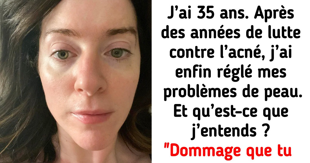 18 Femmes qui sont devenues plus jolies quand elles ont choisi d’ignorer les conseils des autres et leurs propres préjugés