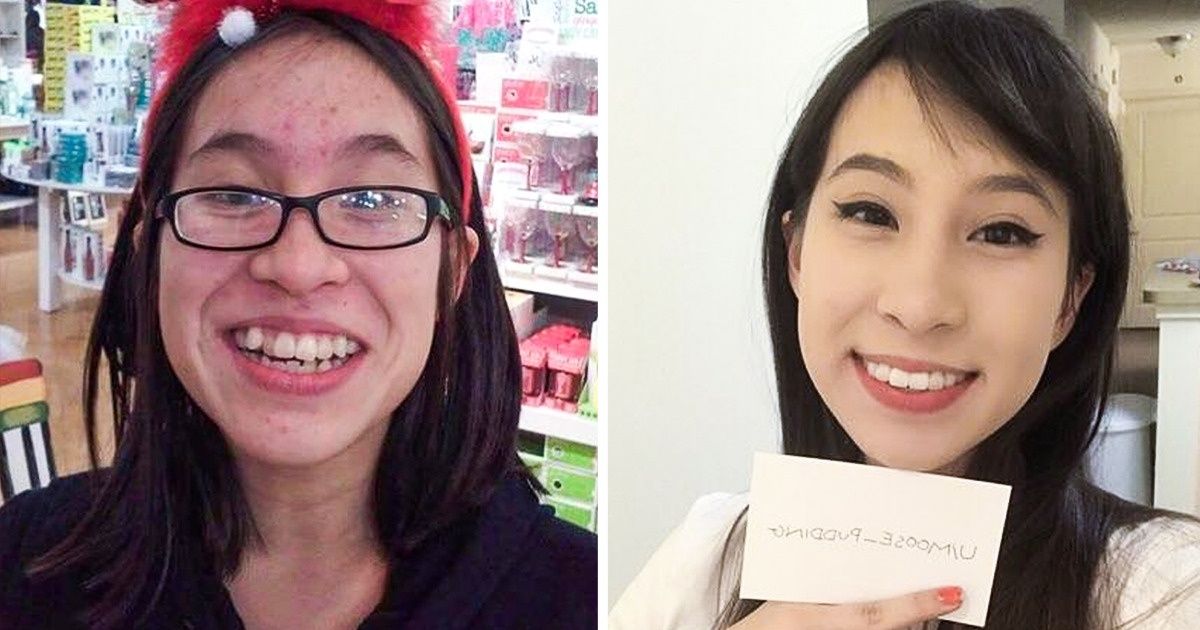 15 Filles qui n’aimaient pas leur physique durant leur adolescence, et qui sont aujourd’hui méconnaissables après leur incroyable métamorphose 15 Filles qui n’aimaient pas leur physique durant leur adolescence, et qui sont aujourd’hui méconnaissables après leur incroyable métamorphose