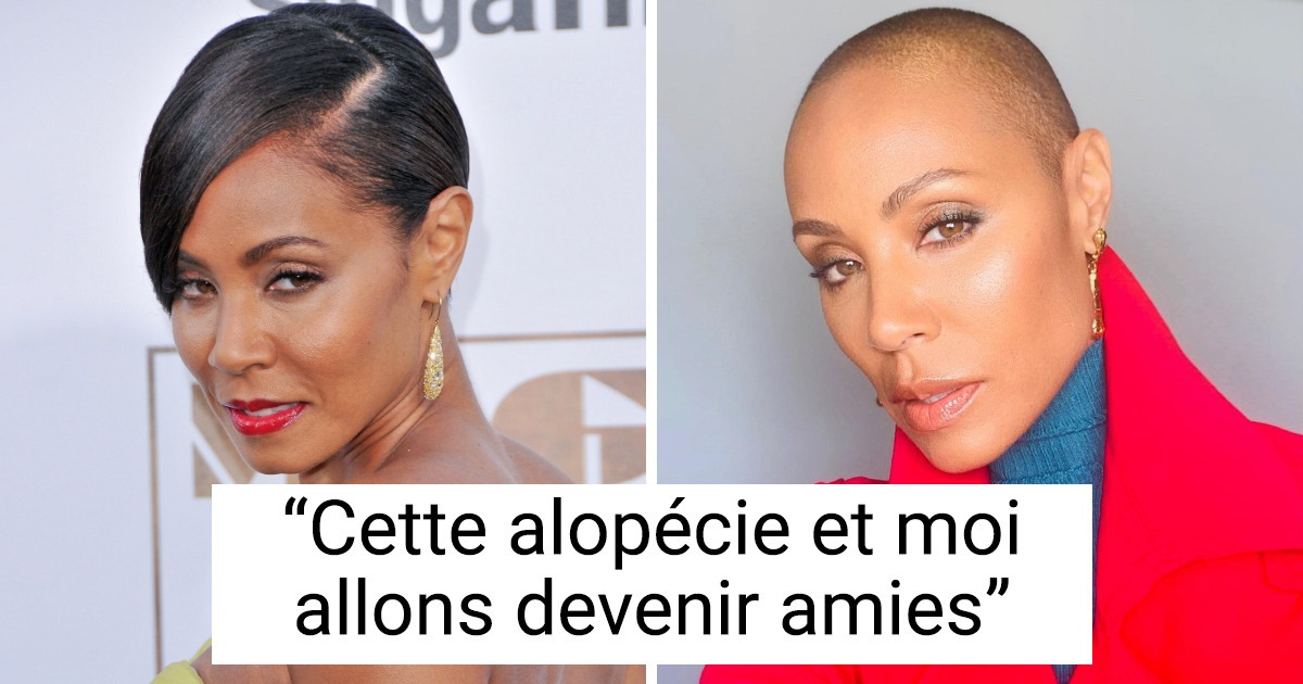 10 Célébrités ont expliqué pourquoi elles se sont rasé la tête, et leur histoire force le respect