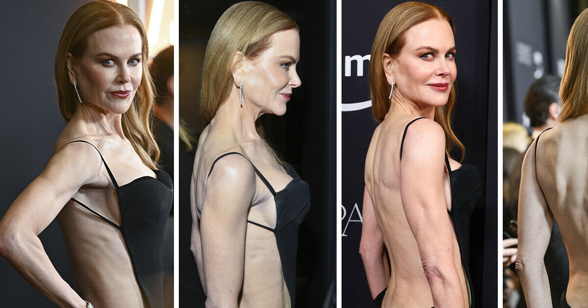 La robe révélatrice de Nicole Kidman suscite une discussion animée La robe révélatrice de Nicole Kidman suscite une discussion animée