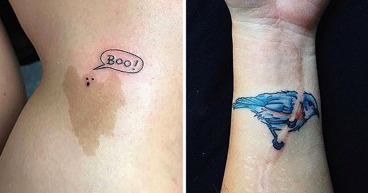 20+ Personnes qui ont vaincu les défauts de leur peau avec un tatouage