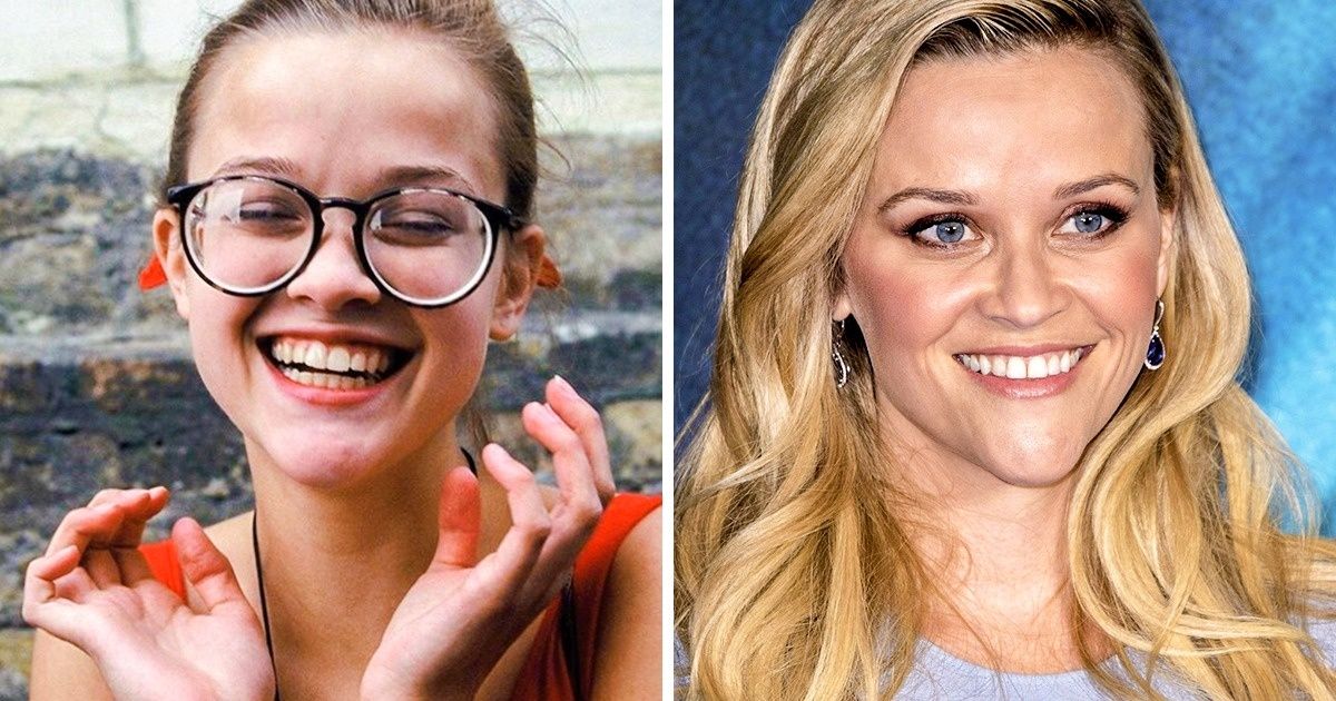 Ces 14 célébrités n’ont pas toujours été belles et aimées de tous lorsqu’elles étaient petites, loin de là... Ces 14 célébrités n’ont pas toujours été belles et aimées de tous lorsqu’elles étaient petites, loin de là...