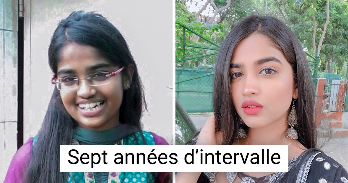 17 Photos qui prouvent que le temps peut faire une différence de taille