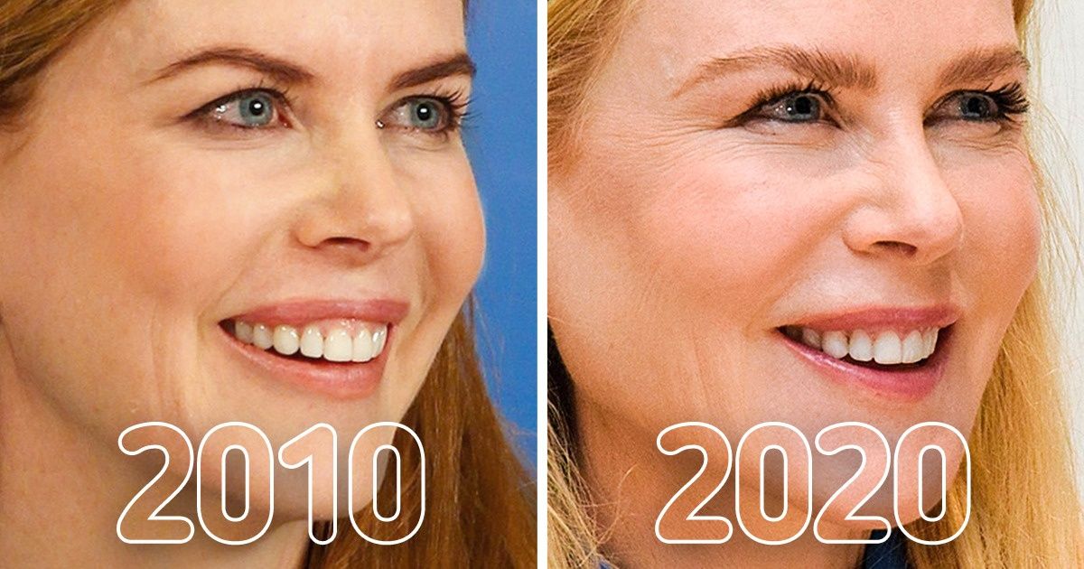 20+ Photos qui montrent comment les stars ont changé ces dix dernières années