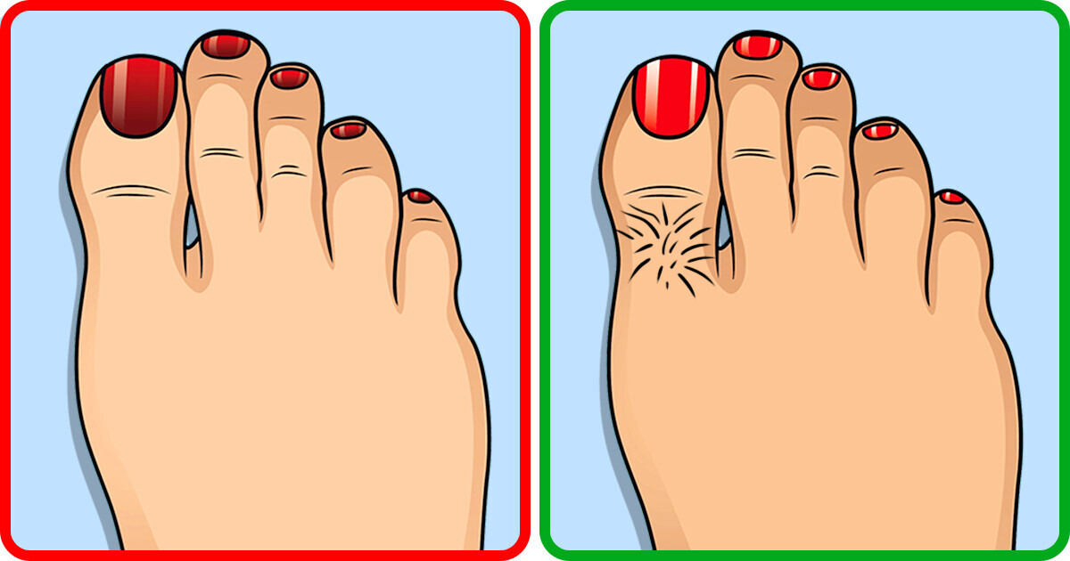 10 Choses que tes pieds peuvent dire sur ta santé