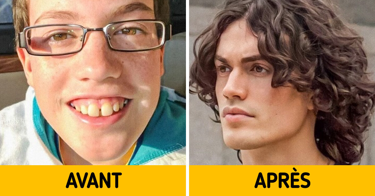 16 Personnes qui se sont tellement épanouies après le cap de l’adolescence