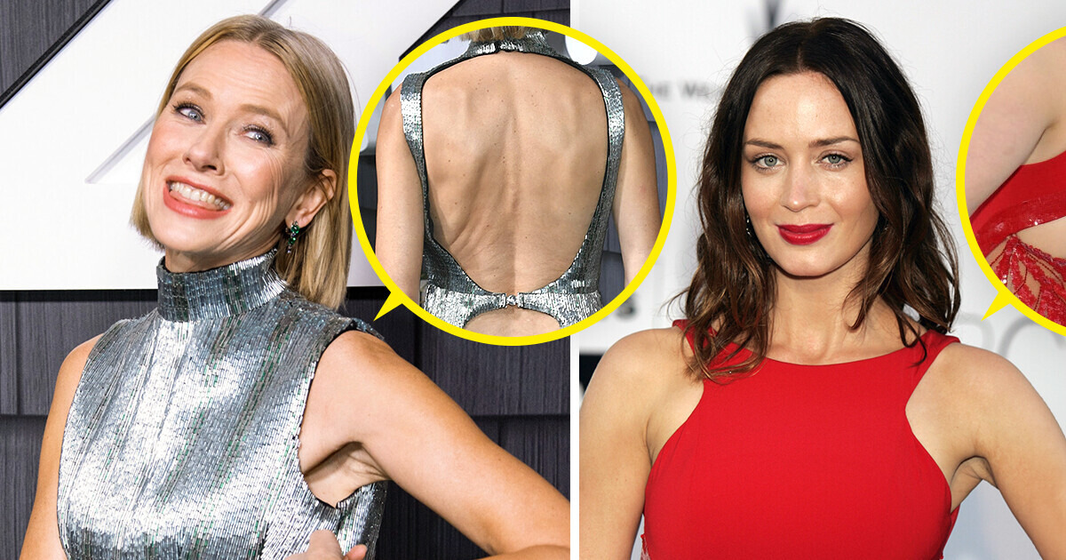 18 Cas où les stars ont dévoilé leur dos et n’ont pas manqué de surprendre tout le monde 18 Cas où les stars ont dévoilé leur dos et n’ont pas manqué de surprendre tout le monde