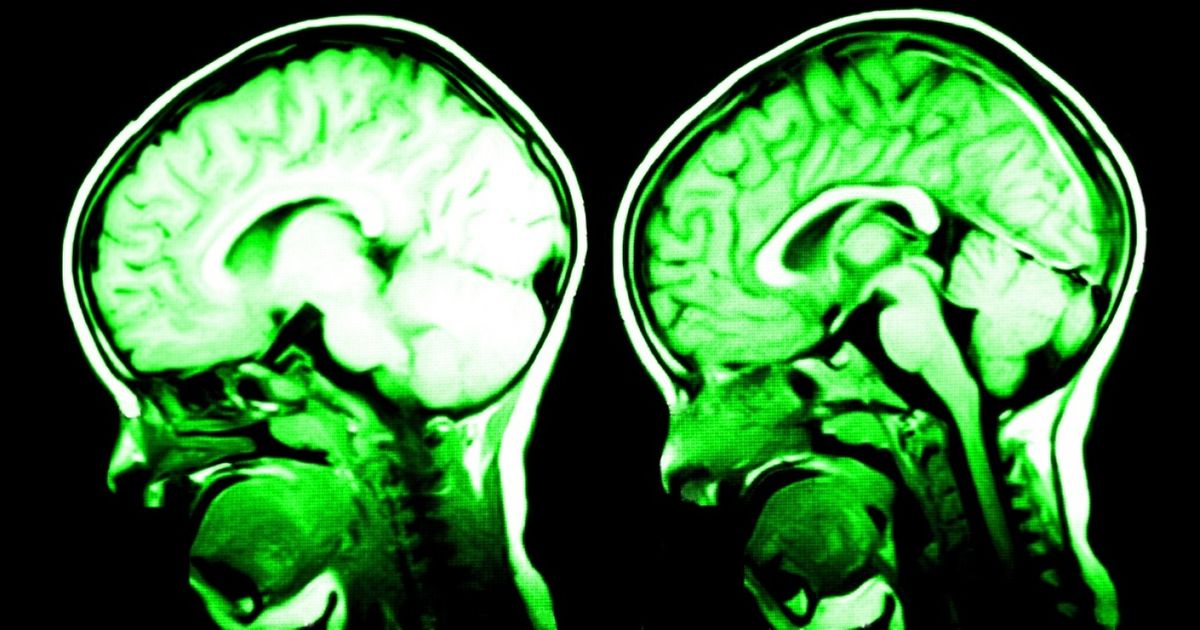 Ces 7 éléments améliorent la capacité de ton cerveau !