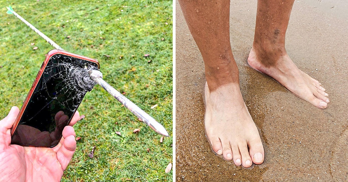 15+ Personnes qui ont battu des records avec leur malchance 15+ Personnes qui ont battu des records avec leur malchance