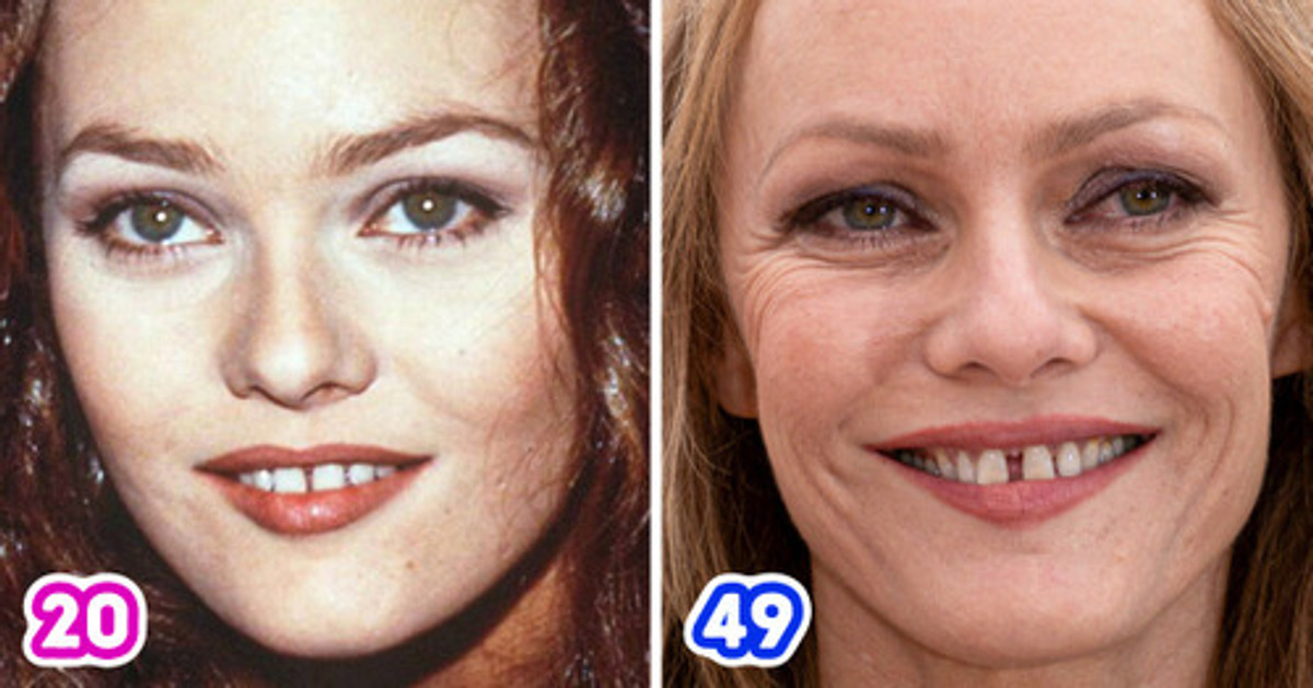 Nous avons zoomé sur les photos de plus de 15 stars qui ont beaucoup changé au fil du temps, ce que nous n’avons pas remarqué