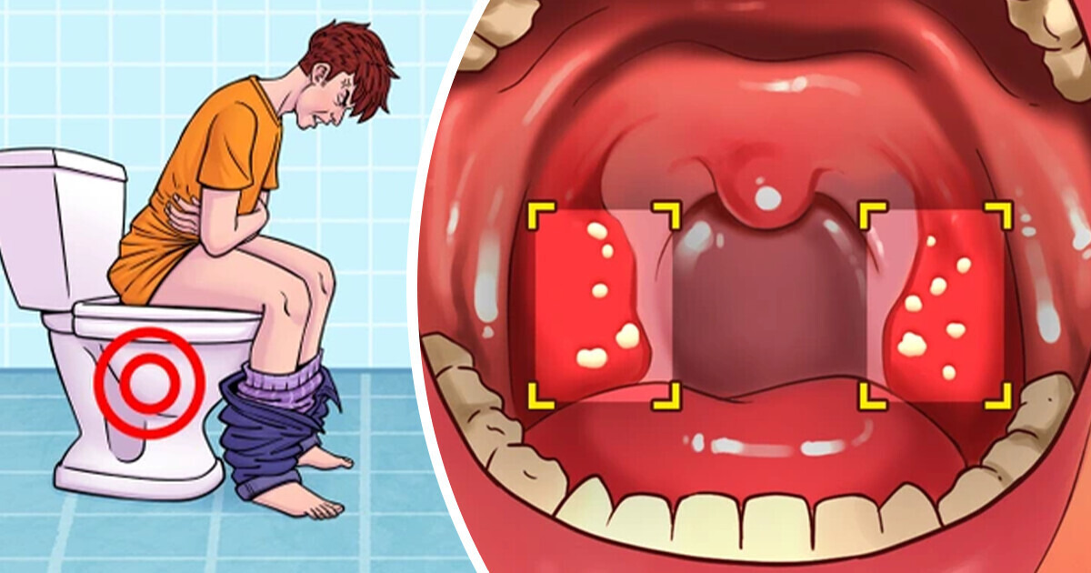 10 Signes indiquant que tu es probablement sensible au gluten 10 Signes indiquant que tu es probablement sensible au gluten