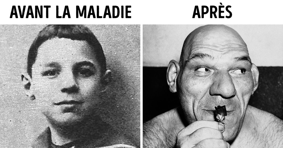 Voici l’histoire du catcheur surnommé The French Angel, que certains d’entre nous considèrent comme le prototype de Shrek Voici l’histoire du catcheur surnommé The French Angel, que certains d’entre nous considèrent comme le prototype de Shrek
