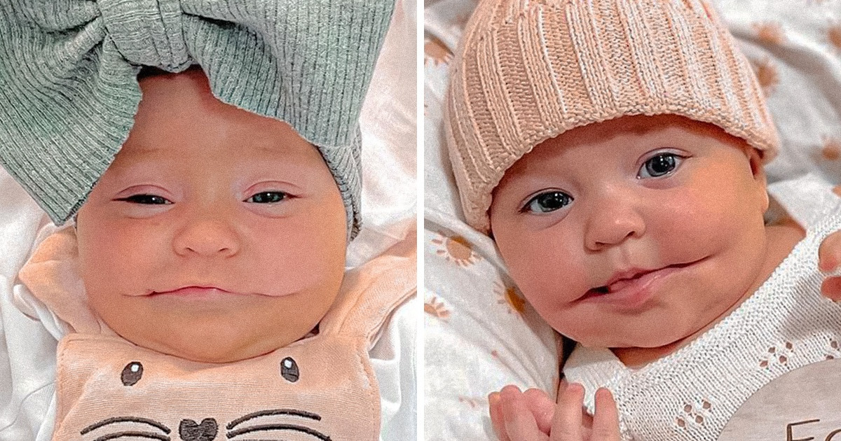 La petite Ayla, la petite fille qui sourit tout le temps, séduit tout le monde avec son problème de bouche rare