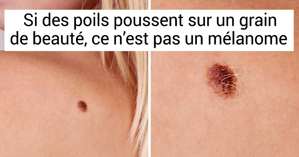 7 Bonnes nouvelles pour ceux qui ont peur d’être atteints de cancer 7 Bonnes nouvelles pour ceux qui ont peur d’être atteints de cancer