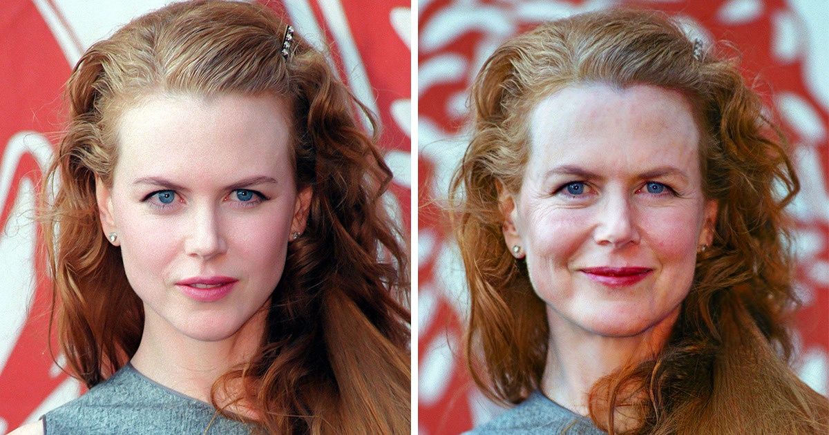 Un chirurgien esthétique révèle à quoi ces 10 célébrités auraient ressemblé si elles avaient vieilli comme tout le monde
