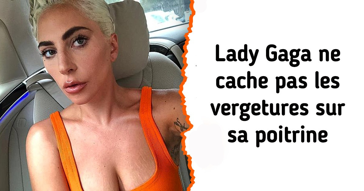 10 Célébrités qui acceptent et affichent fièrement leurs imperfections sans tabou