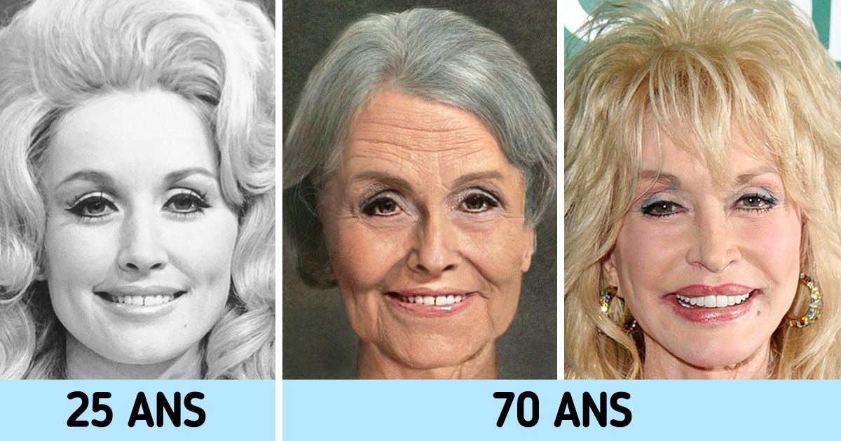 Voici à quoi ces 14 célébrités auraient ressemblé si elles n’avaient pas fait de chirurgie esthétique