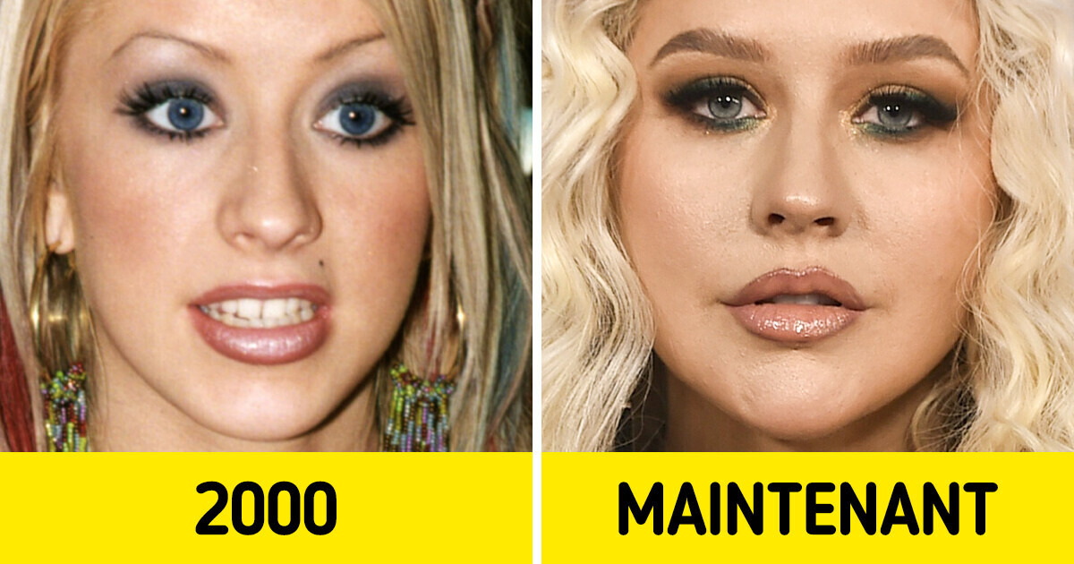 11 Gros plans de célébrités qui montrent comment leurs visages ont changé au fil des décennies